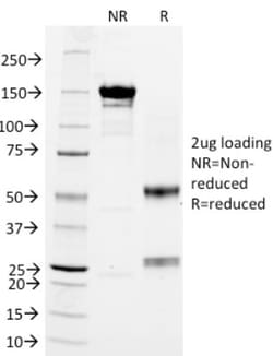 Mouse anti-Integrin beta 2/CD18, Clone: 68-5A5, Novus Biologicals:Antibodies:Primary